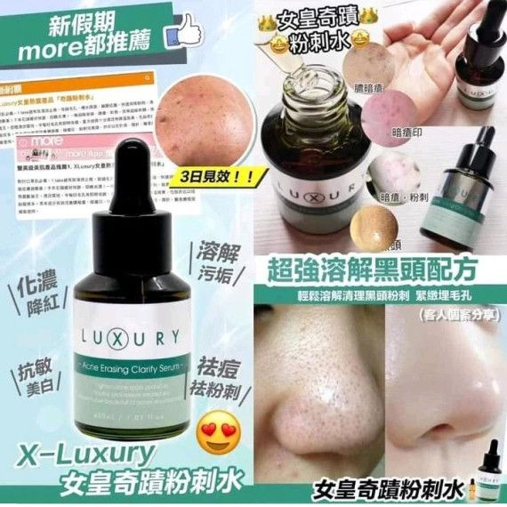 Luxury 女皇奇蹟粉刺水